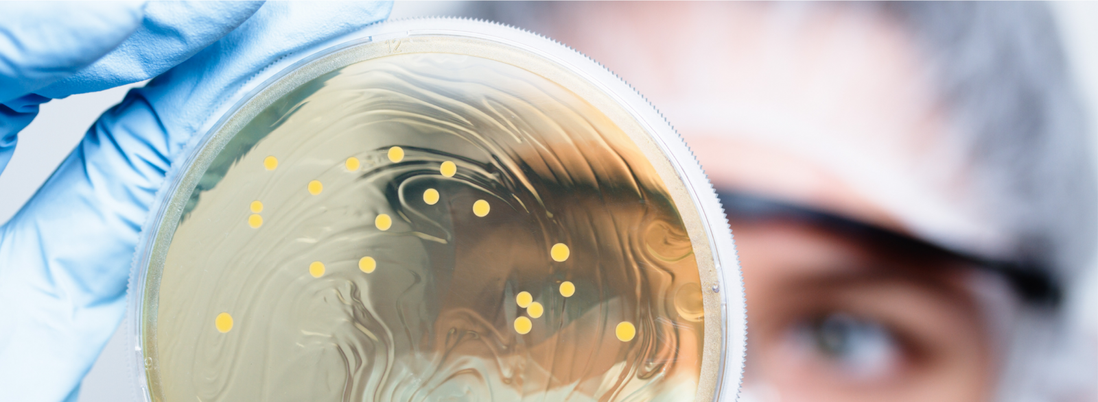 Chủng chuẩn vi sinh Salmonella Typhimurium NCTC 12023